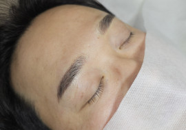 남자눈썹 시술전후가 완전 다른 이미지